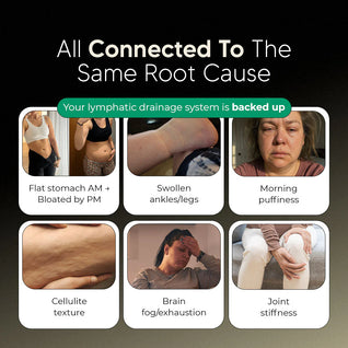 New Maximum Potency Formula - Lymphatic Drainage Capsules by Sculptique™ (Copy)